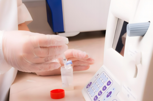 宫颈糜烂怎么诊断出来的（宫颈糜烂的早期症状）